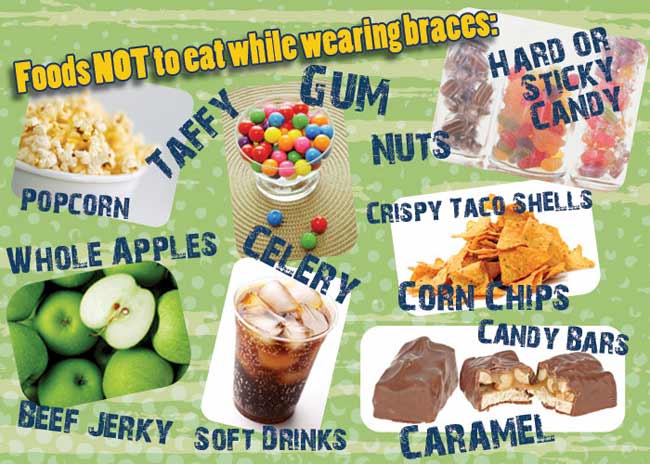 Foods That are Safe for Braces Orthodontist Select