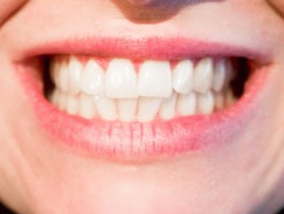 Common Orthodontic Bite Problems Explained